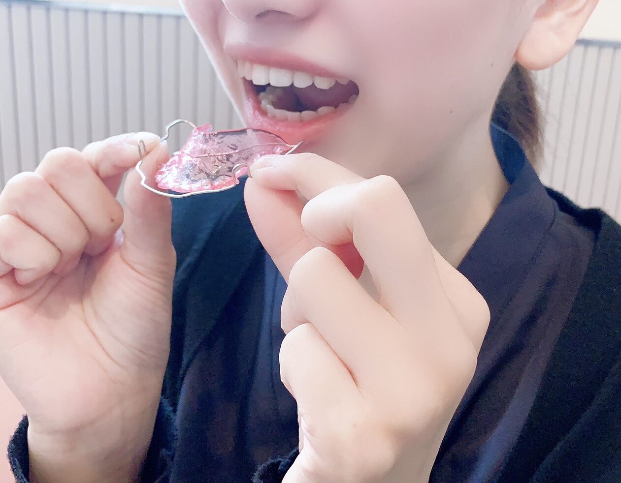 矯正治療後にきれいな歯並びをキープするための 保定期間 について 酒田市 新庄市 鶴岡市エリアのぷらす矯正歯科
